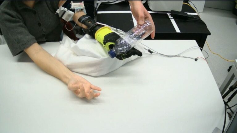 3 soft robotic prosthetic hand uses nerve signals for more natural control